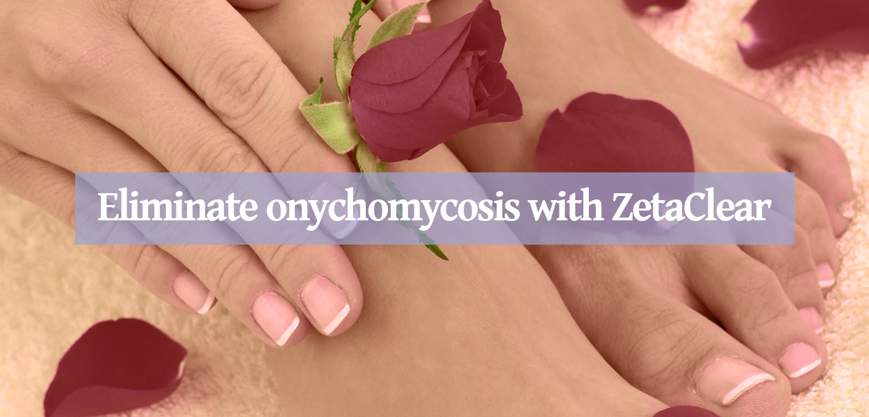 Eliminate Onychomycosis with ZetaClear